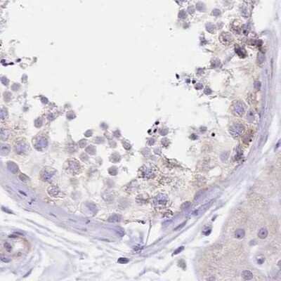Immunohistochemistry-Paraffin: Myozenin 1 Antibody [NBP2-38412]