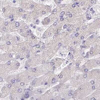 Immunohistochemistry-Paraffin: Myozenin 1 Antibody [NBP2-38412]