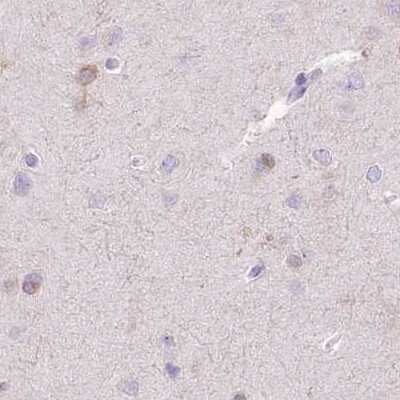 Immunohistochemistry-Paraffin: Myozenin 1 Antibody [NBP2-38412]