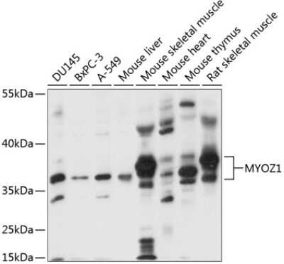 Western Blot: Myozenin 1 AntibodyAzide and BSA Free [NBP3-03528]