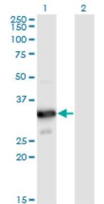 Western Blot: Myozenin 2 Antibody (1D4) [H00051778-M02]