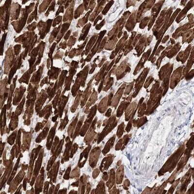 Immunohistochemistry-Paraffin: Myozenin 2 Antibody [NBP1-88259]