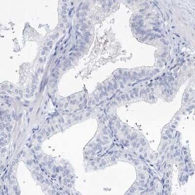 Immunohistochemistry-Paraffin: Myozenin 2 Antibody [NBP1-88259]