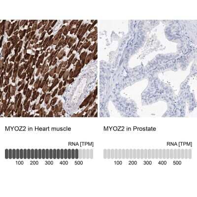 Immunohistochemistry-Paraffin: Myozenin 2 Antibody [NBP1-88259]