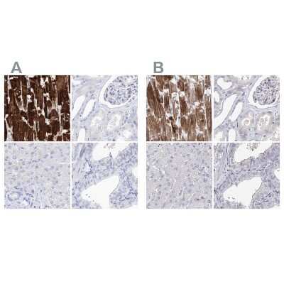 Immunohistochemistry-Paraffin: Myozenin 2 Antibody [NBP1-88259]