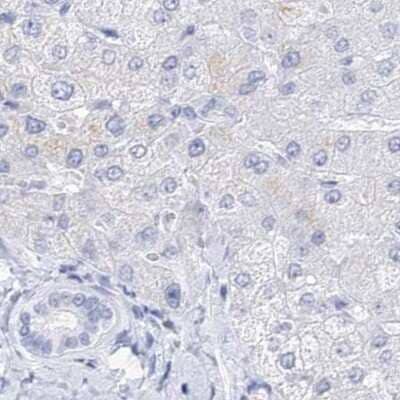 Immunohistochemistry-Paraffin: Myozenin 2 Antibody [NBP1-88259]