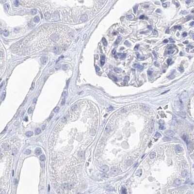 Immunohistochemistry-Paraffin: Myozenin 2 Antibody [NBP1-88259]