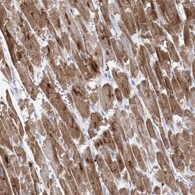 Immunohistochemistry-Paraffin: Myozenin 2 Antibody [NBP2-34020]