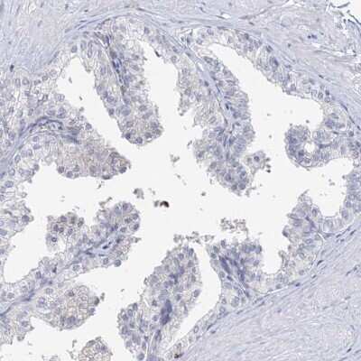 Immunohistochemistry-Paraffin: Myozenin 2 Antibody [NBP2-34020]