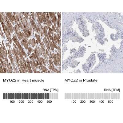 Immunohistochemistry-Paraffin: Myozenin 2 Antibody [NBP2-34020]