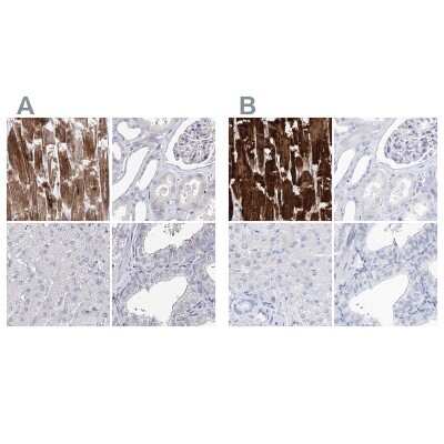 Immunohistochemistry-Paraffin: Myozenin 2 Antibody [NBP2-34020]