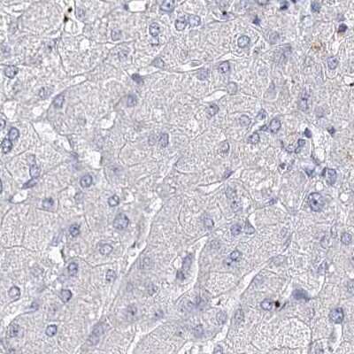 Immunohistochemistry-Paraffin: Myozenin 2 Antibody [NBP2-34020]