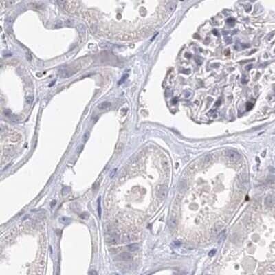 Immunohistochemistry-Paraffin: Myozenin 2 Antibody [NBP2-34020]