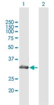 Western Blot: Myozenin 2 Antibody [H00051778-B01P]