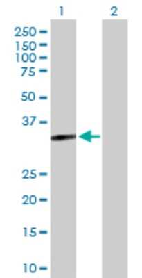 Western Blot: Myozenin 2 Antibody [H00051778-D01P]