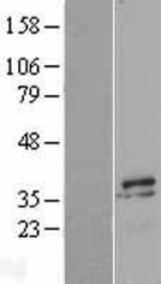 Western Blot: Myozenin 2 Overexpression Lysate [NBL1-13447]