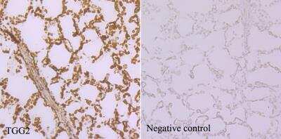 Immunohistochemistry-Paraffin: Myrosinase 2 Antibody (6H1) [NBP2-89159]