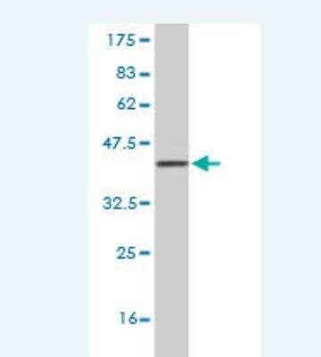 Western Blot: Myt1 Antibody (2A7) [H00004661-M02]