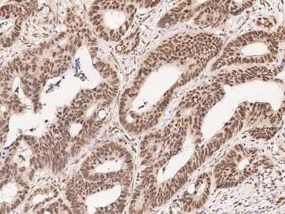 Immunohistochemistry-Paraffin: Myt1 Antibody [NBP2-99008]