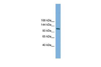 Western Blot: Myt1 Antibody [NBP2-87874]