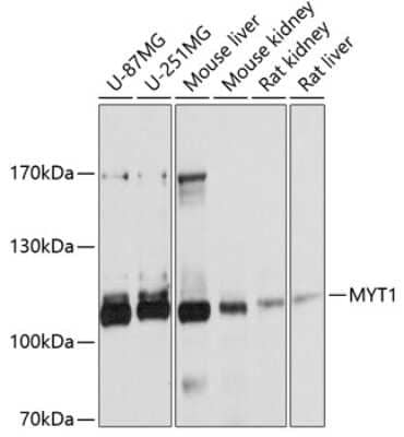 Western Blot: Myt1 AntibodyAzide and BSA Free [NBP2-94362]