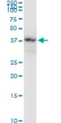 Western Blot: N-Acetyl-D-Glucosamine Kinase/NAGK Antibody (1H8) [H00055577-M05]