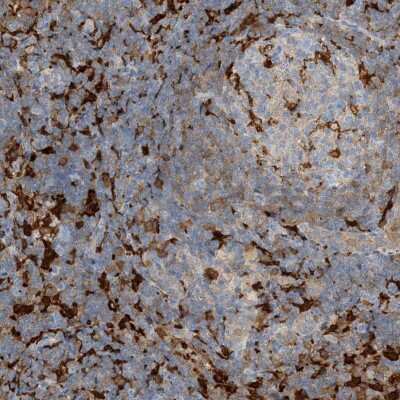 Immunohistochemistry: N-Acetyl-D-Glucosamine Kinase/NAGK Antibody [NBP2-38240]