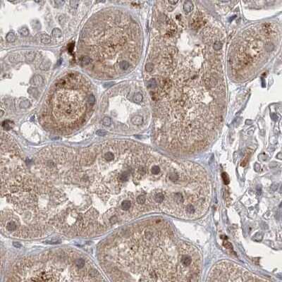 Immunohistochemistry-Paraffin: N-Acetyl-D-Glucosamine Kinase/NAGK Antibody [NBP1-89750]