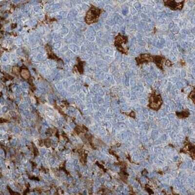 Immunohistochemistry-Paraffin: N-Acetyl-D-Glucosamine Kinase/NAGK Antibody [NBP2-38240]
