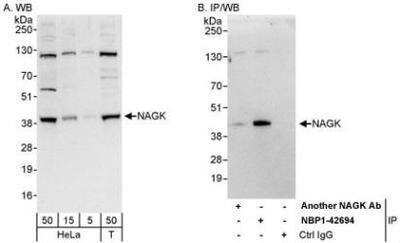 Western Blot: N-Acetyl-D-Glucosamine Kinase/NAGK Antibody [NBP1-42694]