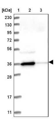 Western Blot: N-Acetyl-D-Glucosamine Kinase/NAGK Antibody [NBP2-38240]