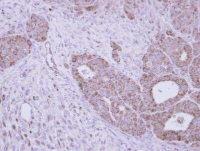 Immunohistochemistry-Paraffin: N-Acetylgalactosamine-6-Sulfatase/GALNS Antibody [NBP1-32899]
