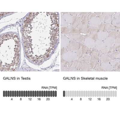 Immunohistochemistry-Paraffin: N-Acetylgalactosamine-6-Sulfatase/GALNS Antibody [NBP2-62607]