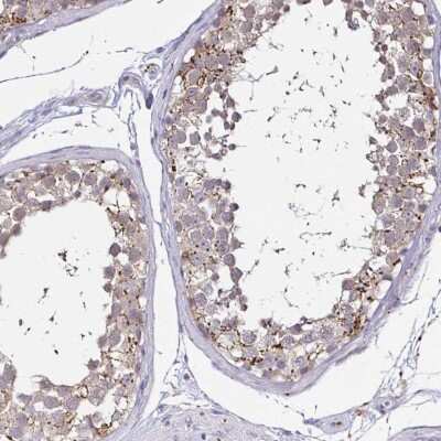 Immunohistochemistry-Paraffin: N-Acetylgalactosamine-6-Sulfatase/GALNS Antibody [NBP2-62607]