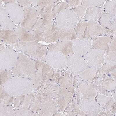 Immunohistochemistry-Paraffin: N-Acetylgalactosamine-6-Sulfatase/GALNS Antibody [NBP2-62607]