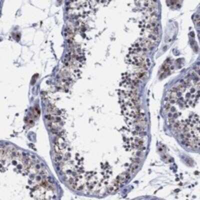 Immunohistochemistry-Paraffin: N-Acetylgalactosamine-6-Sulfatase/GALNS Antibody [NBP3-17895]