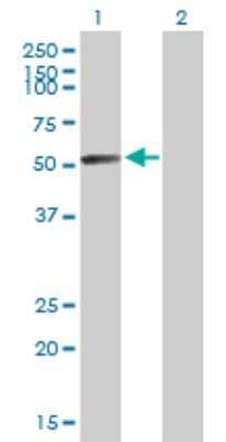 Western Blot: N-Acetylgalactosamine-6-Sulfatase/GALNS Antibody [H00002588-B01P]