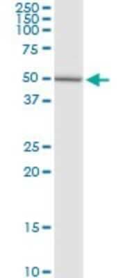 Western Blot: N-Acetylgalactosamine-6-Sulfatase/GALNS Antibody [H00002588-D01P]