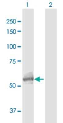 Western Blot: N-Acetylgalactosamine-6-Sulfatase/GALNS Antibody [H00002588-D01P]