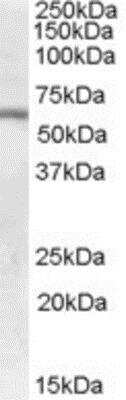 Western Blot: N-Acetylgalactosamine-6-Sulfatase/GALNS Antibody [NBP1-00190]