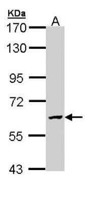 Western Blot: N-Acetylgalactosamine-6-Sulfatase/GALNS Antibody [NBP1-32899]