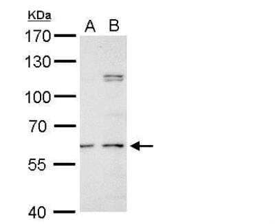 Western Blot: N-Acetylgalactosamine-6-Sulfatase/GALNS Antibody [NBP1-32899]