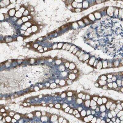 Immunohistochemistry-Paraffin: N-Acetylglucosaminyltransferase III/MGAT3 Antibody [NBP1-81810]