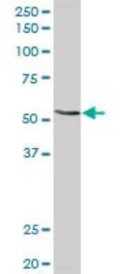 Western Blot: N-Acetylglucosaminyltransferase III/MGAT3 Antibody [H00004248-D01P]