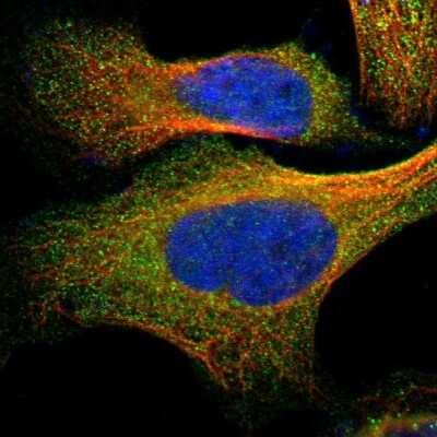 Immunocytochemistry/ Immunofluorescence: N-Acetylmannosamine Kinase/GNE Antibody [NBP1-81622]