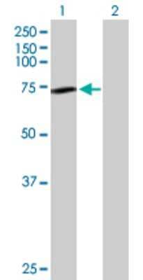 Western Blot: N-Acetylmannosamine Kinase/GNE Antibody [H00010020-D01P]