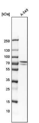 Western Blot: N-Acetylmannosamine Kinase/GNE Antibody [NBP1-81621]