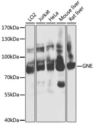 Western Blot: N-Acetylmannosamine Kinase/GNE AntibodyBSA Free [NBP2-94770]