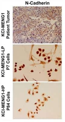 Immunocytochemistry: N-Cadherin Antibody (13A9) [NBP1-48309]