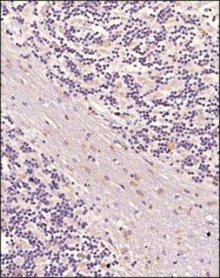 Immunohistochemistry-Paraffin: N-Cadherin Antibody (13A9) [NBP1-48309]